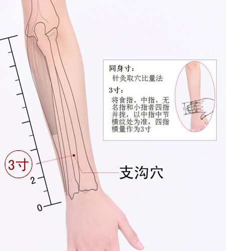 支溝穴→降逆通腑