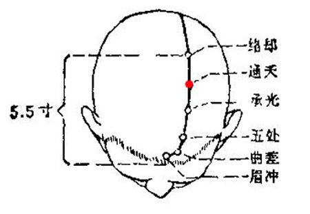 通天穴→通利開(kāi)竅