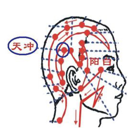 天沖穴→治頭痛、齒痛