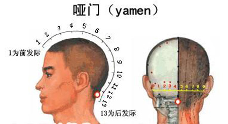 啞門穴→治音啞、頭痛