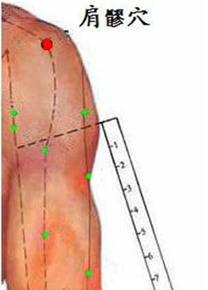 肩髎穴→緩解肩臂疼痛