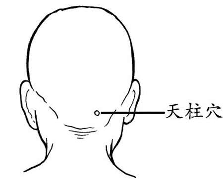 天柱穴→治頭痛、項強