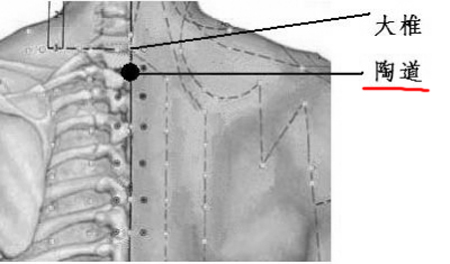 陶道穴→治頭痛項(xiàng)強(qiáng)