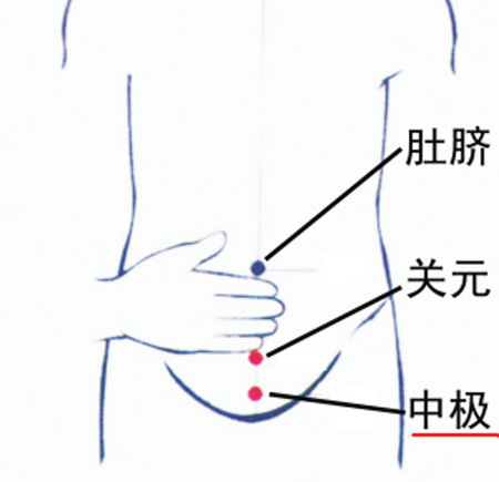 中極穴：補(bǔ)腎培元，調(diào)治陰挺、不孕