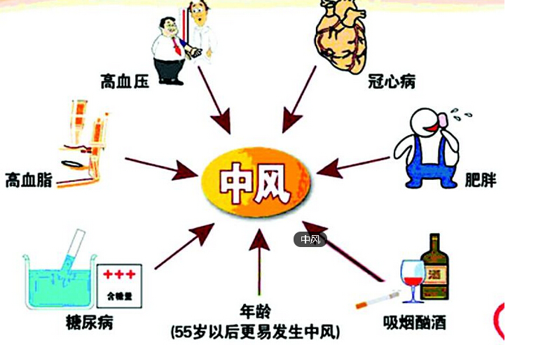 特色中醫(yī)拔罐治療中風(fēng)的方法