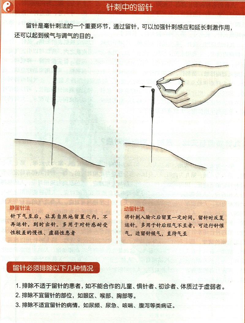 針刺穴位時(shí)有哪些需要注意的？