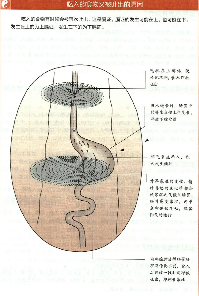 嘔吐應(yīng)怎樣治療？