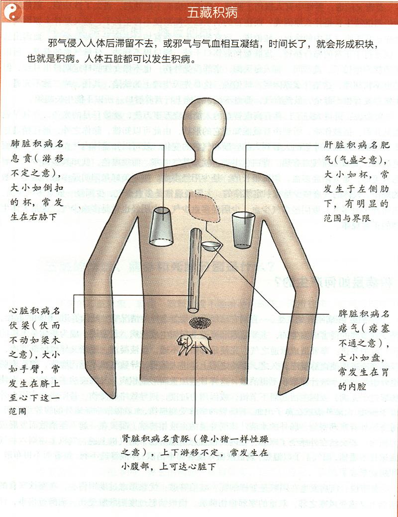 積病是如何產(chǎn)生的？